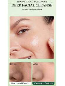 100g Lemon Vitamin C Exfoliating Gel, Suitable For Face And Body, Removes Dead Skin Cells, Improves Roughness And Keratosis, Deeply Moisturizes The Skin - Lemon VC - View 6