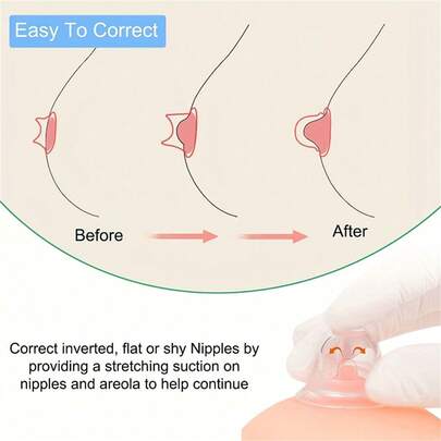 Silicone Breast Pump, No Electricity Needed, Suitable For Flat & Inverted Nipples, Adjustable Suction, Breastfeeding Assistance Tool