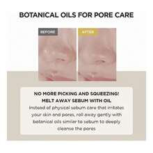 Skin10 04 Madagascar Centella Light Cleansing Oil 200ml Todo Tipo De Piel Noche - Amarillo Mostaza - Ver 4