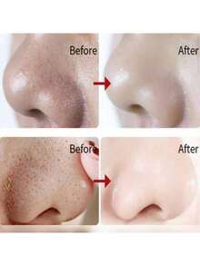 20 miếng dán lột mụn mũi dùng một lần, giúp thu nhỏ lỗ chân lông, loại bỏ mụn đầu đen và mụn đầu trắng, làm sạch và dịu da, giúp giảm lượng dầu thừa ở mũi, phù hợp cho cả nam và nữ, món quà Giáng sinh/Ngày lễ tuyệt vời. - Miếng dán trị mụn đầu đen - Xem 8
