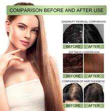 草本护发油 - 温和滋养头皮，强健发质，清洁头皮，令秀发柔顺亮泽。 - 正裝 - 查看 5