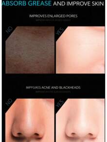 便携式火山岩吸油球，面部吸油，收缩毛孔，家用清洁美容化妆工具 - 淺灰色 - 查看 7