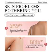 400毫升谷胱甘肽和烟酰胺身体乳，SPF50+，含α-熊果苷，美白保湿，滋养肌肤，提升肌肤紧致度，令肌肤细腻柔滑。 - Niacinamide - 查看 6