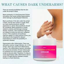 50克腋下美白霜，淡化腋下、关节和肘部肤色，保湿亮肤霜 - 1pc - 查看 6