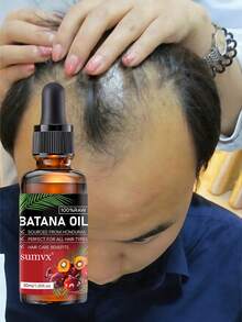 Aceites Esenciales Para El Tratamiento Del Cabello, Fortalece Las Raíces, Reduce La Pérdida De Cabello Y Agrega Brillo, Suave, Libre, Fácil De Usar, Peine, Protege El Crecimiento Saludable - 30ml/1.014 fl.oz - Xem 6