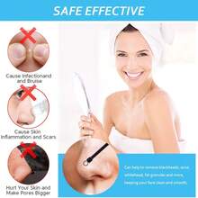 祛痘黑头工具套装 - 祛痘黑头、淡化痘印、提亮肤色、护肤、女士美容、毛孔清洁工具、深层清洁工具、面部护理工具、毛孔清洁钩 - 多色 - 查看 6