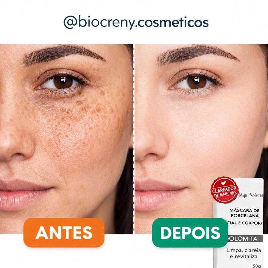 KIT 2 Anti-Wrinkle Dolomite Cream, Skin Lightener, Facial Rejuvenator, Reduces Expression Lines, Melasma, And Acne - 1 Creme - 查看 1