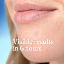 360pcs Transparent Round Multi-Functional Scar Covering Patches, Effectively Conceal Scars And Blemishes On Various Body Parts (Not For Cosmetic Purposes) - View 8