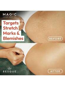 Besque Magic Body Oil, 3.38 FL OZ, After Shower Body Oil For Women, Hydrating Skin Care For Full Body That Plumps, Tightens, And Firms Skin With Natural Ingredients, Luxury Spa Gifts - Pack Of 1 - Hương vị trà - Xem 4