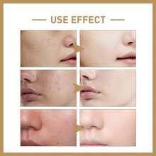 EELHOE Rice Toner Facial Skincare Moisturizing Smoothing Radiant Brightening Shrink Pores Refine Skin Texture Oil Control Sensitive Skin Care Toner - Rice - View 2