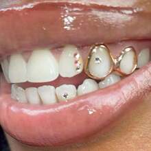 1pc Unique Square Double Hollow Metal Hiphop Tooth Jewelry, Unisex Party & Daily Accessory - Multicolor - View 1