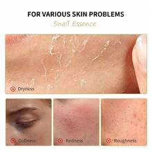 15克蜗牛精华眼霜，深层滋养眼部护理，减少眼袋和黑眼圈，提亮肤色，淡化细纹 - 蝸牛 - 查看 8