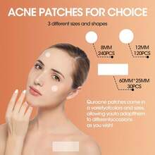 Large Hydrogel Acne Patch, 195 Pieces/Box Deep Cleaning Acne Patch, Alcohol Free, Non Irritating, Effective Coverage Of Acne Scars, Essential For Skin Care For Men And Women - Multicolor - View 4