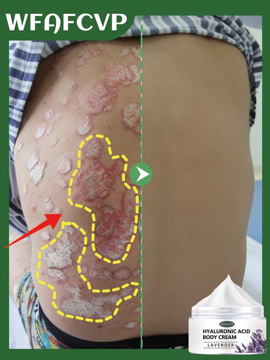 胶原蛋白增生紧致保湿身体乳 - 无香精,蕴含沉香油、椰子油和维生素E,适合所有肤质 - 彩色 - 查看 1