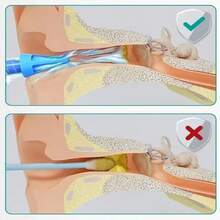 2pcs Ear Wax Cleaning Tool, Ear Wax Cleaning Spray Head, Adult Healthy Ear Care - One Size - View 3