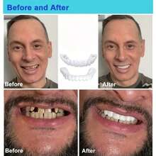 2/4pcs New Natural Fitting Tooth Jewelry Decorations, Suitable For Daily Wear And Party Temporary Use - White 4 - View 3