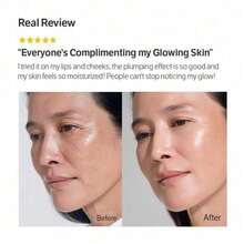 Niacinamide Acne-Reducing Cream Moisturising And Repairing, Serum For Face Supports Collagen Production With Plumping Hyaluronic Acid & Amino Acids - Trắng - Xem 5