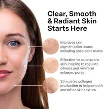 A313French Pharmacy Vitamin A (Retinoids) Lightweight Face Cream For Anti-Aging, Reduce Wrinkles, Prevents Acne Breakouts, And Hyperpigmentation - Skincare... - 維生素 C - 查看 3
