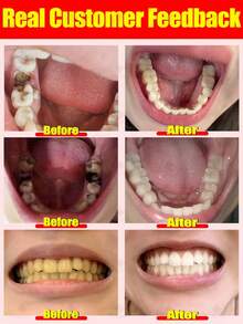 Oralhoe Oral Cleaning And Care Toothpaste Tablets Freshly Protect Enamel Mild Ingredients Care Toothpaste Tablets Whitening And Cleaning Teeth Removing Dental Stones - 1 - Xem 2