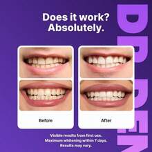Teeth Whitening Strips, 7/21 Treatments, Non-Allergenic Formula, Peroxide-Free,  Enamel Care Kit. - 打條 - 查看 8