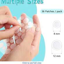 360pcs Transparent Round Multi-Functional Acne Patch, Effective For Covering Scars And Blemishes On Various Body Parts (Not For Beauty Purposes) - View 3