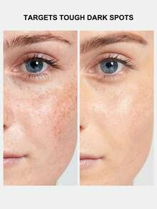 Clinique 倩碧匀净卓效祛斑精华液 - 0.34 液体盎司/10毫升 - mini 10ml - 查看 8