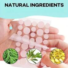 360片祛痘贴，疤痕遮盖贴，多种尺寸和形状，有效遮盖身体上的疤痕和瑕疵（仅限用于遮盖疤痕） - 查看 8