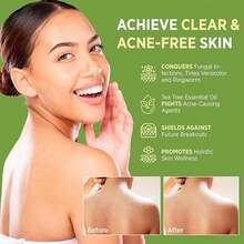 Tea Tree Essential Oil Soap Handmade Soap,Shower Essentials , Deep Cleansing Skin,Body Care Moisturizing Skin Suitable,Hygiene Products,Bathroom Accesssories Suitable For All Skin Types, Essential For Summer Travel 12pcs (100g Soap * 6+Foam Mesh * 6) - 茶樹款 - 查看 7