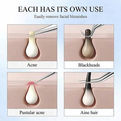 3Pcs Professional Precision Tweezers Set, High Hardness Rustproof Stainless Steel Skincare Tool With Ultra Fine Sharp Tips, Multi-Functional Blackhead Remover & Pimple Comedone Extractor, Eyebrow Shaping & Facial Hair Beard Plucking Tweezers With Strong Secure Grip, Painless Easy To Use Design, Ideal Beauty Grooming Kit For Men Women & All Skin Types, Perfect For Home & Salon Daily Skincare Use