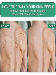 1 pieza Guantes exfoliantes profundos - Elimina eficazmente la piel muerta, suave y radiante - Exfoliante corporal de baño - Limpia la piel muerta y seca - Guantes exfoliantes suaves y eficaces, Esponja exfoliante corporal coreana suave y eficaz para eliminar la piel muerta y la suciedad, Adecuado para mujeres y hombres, Decoración de sala de estar, dormitorio y baño del hogar, Artículos de viaje, Boda, Fiesta, Cumpleaños, Regalo para novio, mamá, papá, amigos, Año Nuevo, Accesorios, Regalo divertido - multicolor - Ver 3