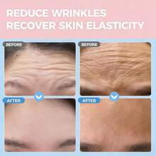 5/10pcs Anti-Wrinkle Forehead Patches, Wrinkle Care Hydrogel Forehead Wrinkle Remover Patches, Lifting & Firming Face Wrinkle Remover Patches, Suitable For Forehead & Face Area, Unisex, Ideal Gift For Women On Occasions Like Valentine's Day, Mother's Day, Halloween, Christmas, Travel, Birthday, Etc. - Multicolor - View 4