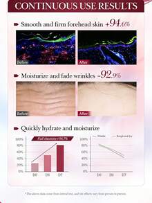 5/10pcs Anti-Wrinkle Forehead Patches, Wrinkle Care Hydrogel Forehead Wrinkle Remover Patches, Lifting & Firming Face Wrinkle Remover Patches, Suitable For Forehead & Face Area, Unisex, Ideal Gift For Women On Occasions Like Valentine's Day, Mother's Day, Halloween, Christmas, Travel, Birthday, Etc. - Multicolor - View 5