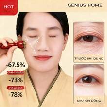 2 piezas Herramientas de masaje facial de latón puro | Pasta exfoliante con forma de loto para la cara, masajeador de acupresión para ojos y rostro, para el cuidado de la piel, masajeador facial de madera para belleza facial, masaje de ojos, acupresión y cuidado de la piel - Multicolor - Ver 3