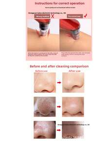 Electric Silicone Facial Cleansing Device - 2-In-1 With Red & Blue Light Therapy USB Portable - View 8