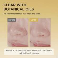 SKIN1004 Madagascar Centella Cleansing Oil 200ml For Sensitive Skin, Remove Makeup, Remove Impurities, Korean Skincare Oil Cleanser, Lightweight Makeup Remover, Dry Skin Friendly Cleansing Oil, Acne-Prone Skin Cleanser, Redness Soothing Cleanser, Makeup Remover Oil, Non-Greasy Cleansing Oil, Bestseller Korean Skincare,  Top Selling Cleaning Oil, Summer, Bikini, Best Selling Skincare, Top Rated Facial Cleaning, Y2k - 金色 - 查看 2