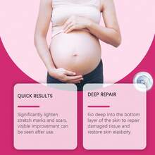 EELHOE Pregnancy Skin Care Kit For Stretch Marks And Scars, 4 Pc Includes Stretch Mark Oil, Stretch Mark Body Wash, Stretch Mark Cream, And Body Lotion, Pregnancy And Maternity Stretch Marks, Gift For Mom To Be, 4 Piece Full Size Set - Formal Wear - View 6