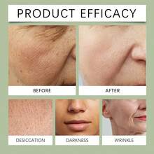 Skin Care Sets - Kit De Cuidado Facial - View 6