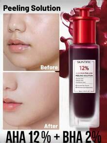 AHA 12% + BHA 2% 精华液，去角质，改善肤质不均和肤色暗沉问题，焕活肌肤，1 瓶 30 毫升/1.01 液盎司 - AHA (Alpha Hydroxy Acid) - 查看 1