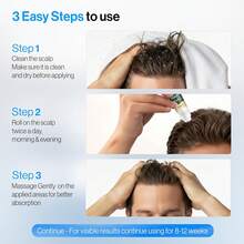 Xioimy 15毫升乌斯曼草和柏树头皮按摩精华，360°按摩滚轮设计，草本植物精华，减少DHT头皮精华 | 舒缓头皮，强健发根，使稀疏头发看起来更浓密丰盈，男女皆宜 [圣诞礼物] - 正裝 - 查看 2