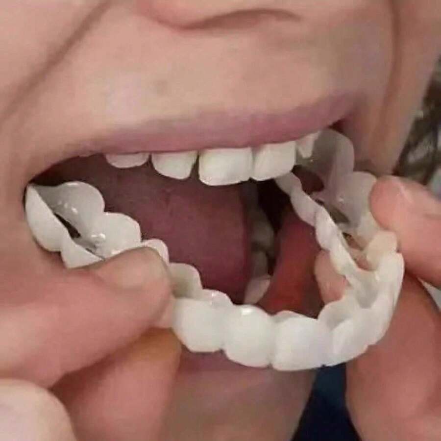 1pc New Upper And Lower Teeth Simulation Braces, Teeth Whitening Silicone Dentures, Smile Dentures,Second-Generation Silicone Artificial Teeth Dentures For Whitening - White - View 1