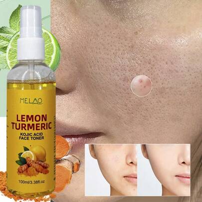  MELAO Tónico de limón y cúrcuma con levadura, que contiene limón natural, cúrcuma y ácido de levadura, iguala el tono de la piel, reduce los poros, refresca y equilibra la piel, apto para todo tipo de pieles, 100ml/3.38 Fl Oz