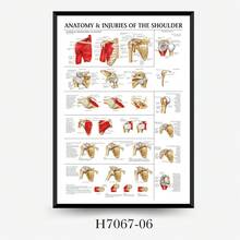 Muscle System Anatomy Chart - Frameless Human Muscle Anatomy Poster, Suitable For Fitness And Exercise Education Sticker - A - View 11