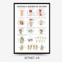 Muscle System Anatomy Chart - Frameless Human Muscle Anatomy Poster, Suitable For Fitness And Exercise Education Sticker - A - View 4