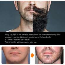 1pc Stainless Steel Micro-Needle Roller, Suitable For Face, Beard, Head, Body, Unisex - Black - View 4