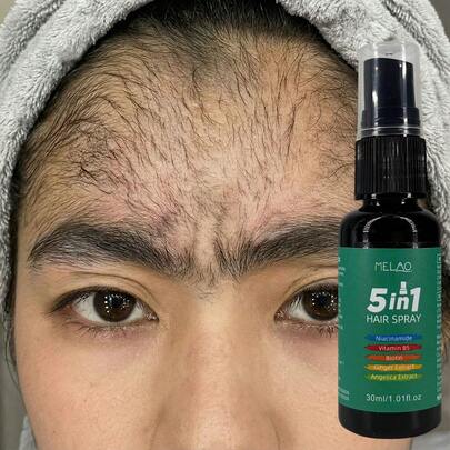  MELAO 5合1强韧秀发喷雾，蕴含烟酰胺和生物素 - 30毫升，丰盈护理，令秀发更浓密丰盈 | 蕴含生姜和当归提取物 | 富含维生素B5 | 每日使用，滋养头皮，强韧秀发