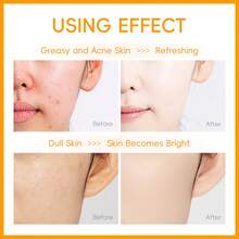 深层清洁泡沫 | 蕴含天然成分，温和洁面 | 去除杂质和多余油脂 | 适合所有肤质 - 深層清潔 - 查看 6