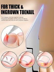 ANDVICTORY 1pc Ingrown Toenail Nipper/Ingrown Toenail Clipper, High Quality Callus Layer Nail Trimmer, Professional Manicure Pedicure Tool - Multicolor - View 2