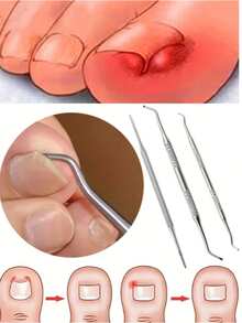 Bộ dụng cụ xử lý móng chân mọc ngược bằng thép không gỉ (1/3 món) - gồm dũa móng hai mặt, dụng cụ nâng, xẻng và đẩy móng; dùng để làm sạch, loại bỏ móng chân mọc ngược và làm sạch chất bẩn trên móng chân. - A - Xem 1
