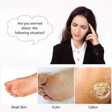 1/2 Pcs (4-In-1) Pedicure Set, Including Pumice Stone, Hand And Toe Nail Cleaning Brush, Metal File And Sandpaper Board, And Nail Foot Scrub Callus Remover Set - Multicolor - View 3