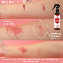 Xịt tẩy tế bào chết toàn thân FATAZEN 180ml AHA, tẩy tế bào chết nhẹ nhàng cho tay, chân, lưng, giảm dày sừng nang lông, dưỡng ẩm cho da thô ráp. - Axit trái cây - Xem 7